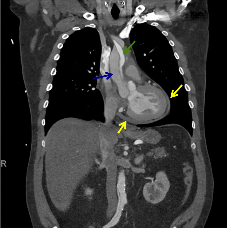 PMC10234142 – FIG7