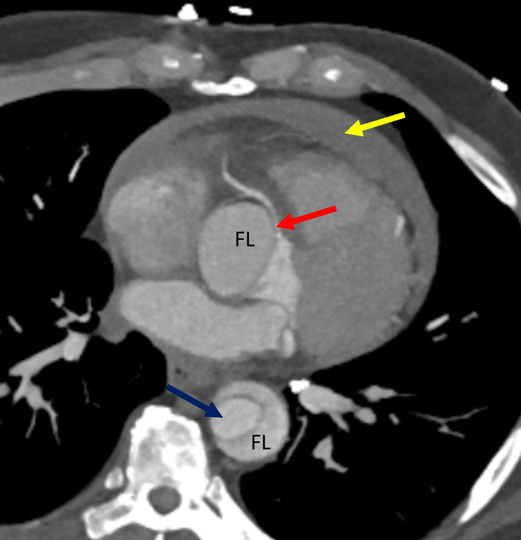 PMC10234142 – FIG8