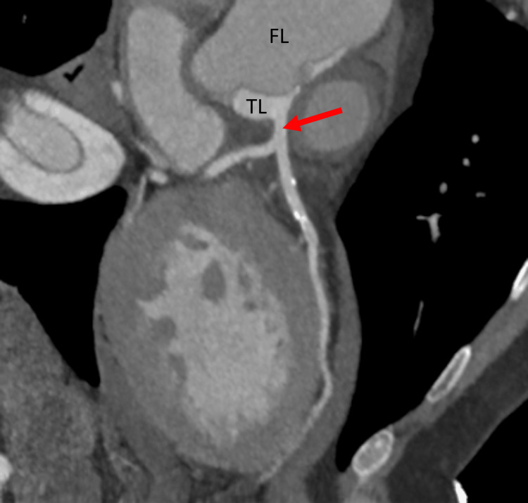 PMC10234142 – FIG9