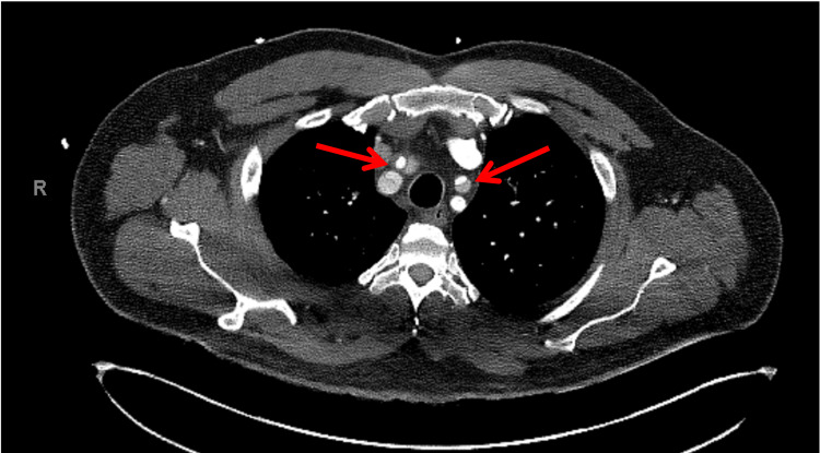 PMC10234142 – FIG10