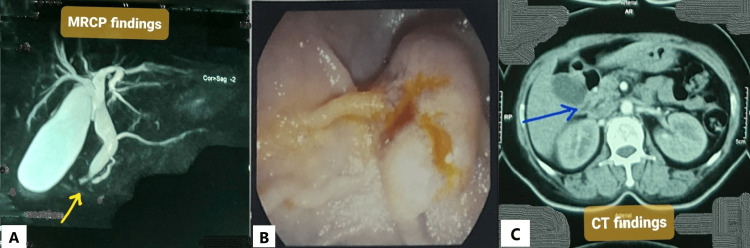 PMC10239650 – FIG1