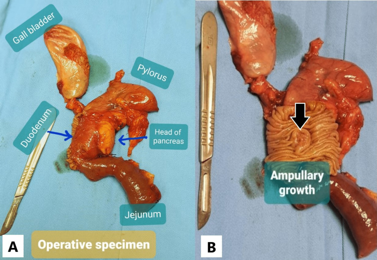 PMC10239650 – FIG2