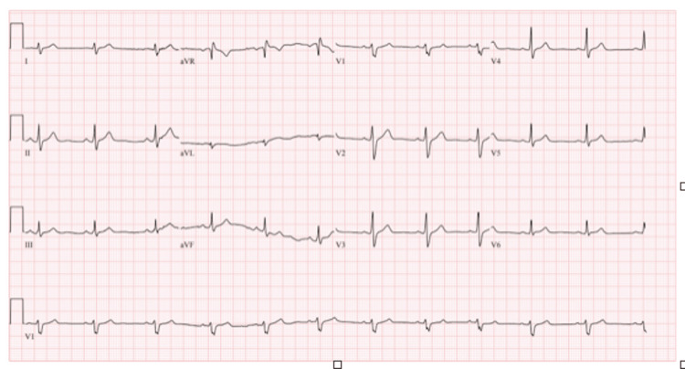 PMC10287544 – FIG1