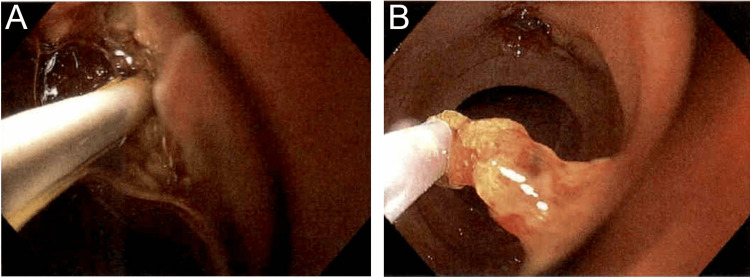 PMC10421727 – FIG3