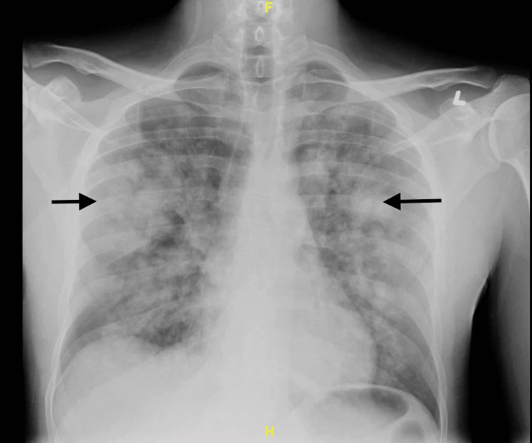 PMC10423625 – FIG1