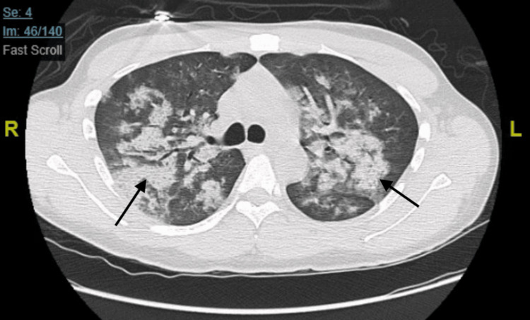PMC10423625 – FIG2