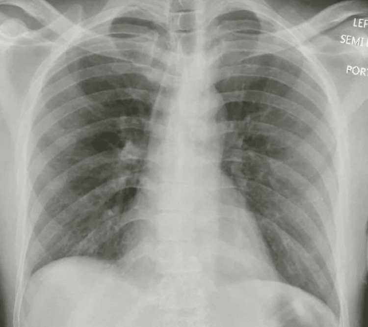 PMC10423625 – FIG4