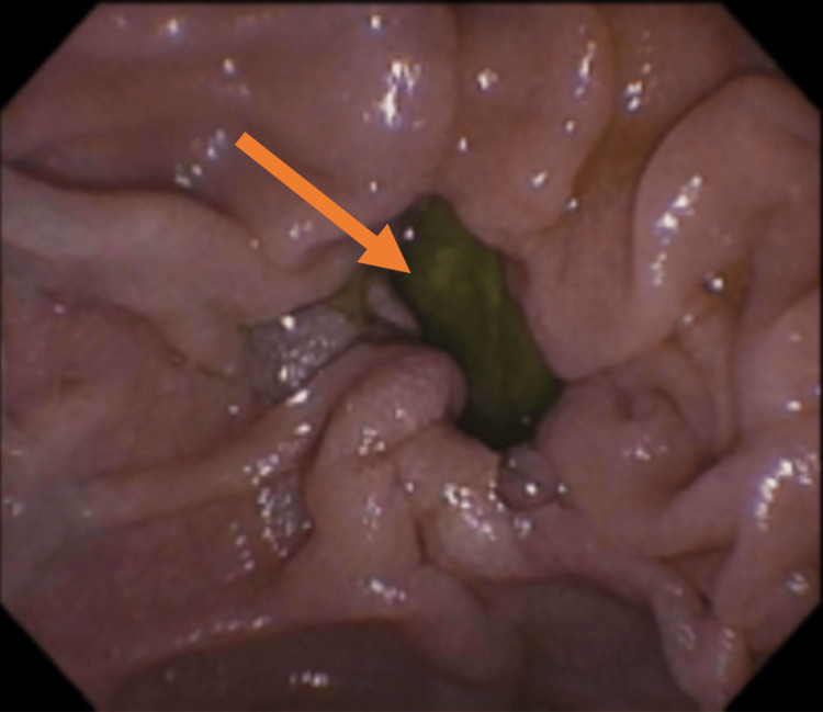 PMC10439679 – FIG1