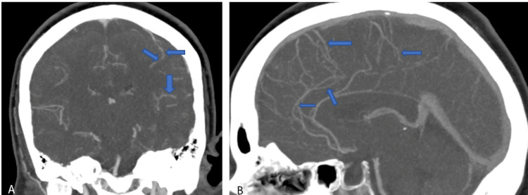 PMC10476695 – FIG2
