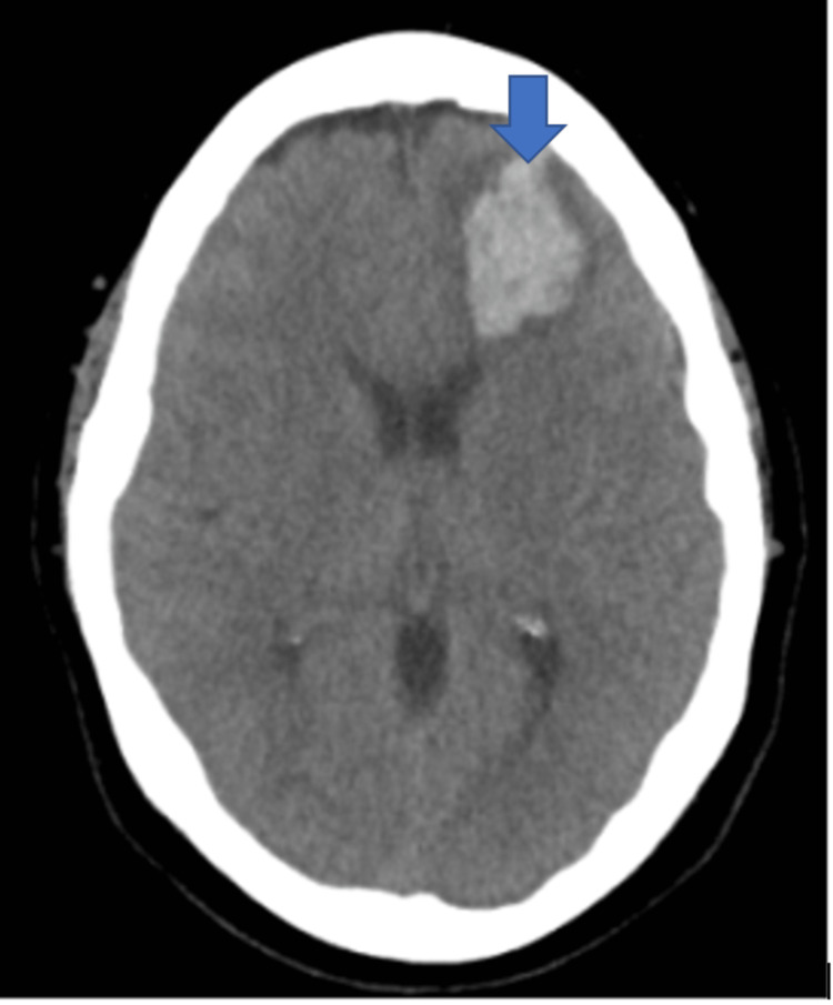PMC10476695 – FIG3