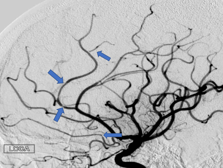 PMC10476695 – FIG4