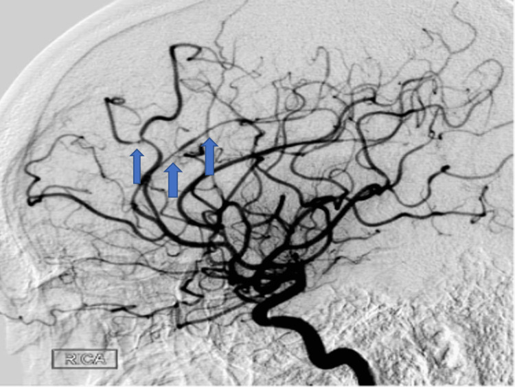 PMC10476695 – FIG5