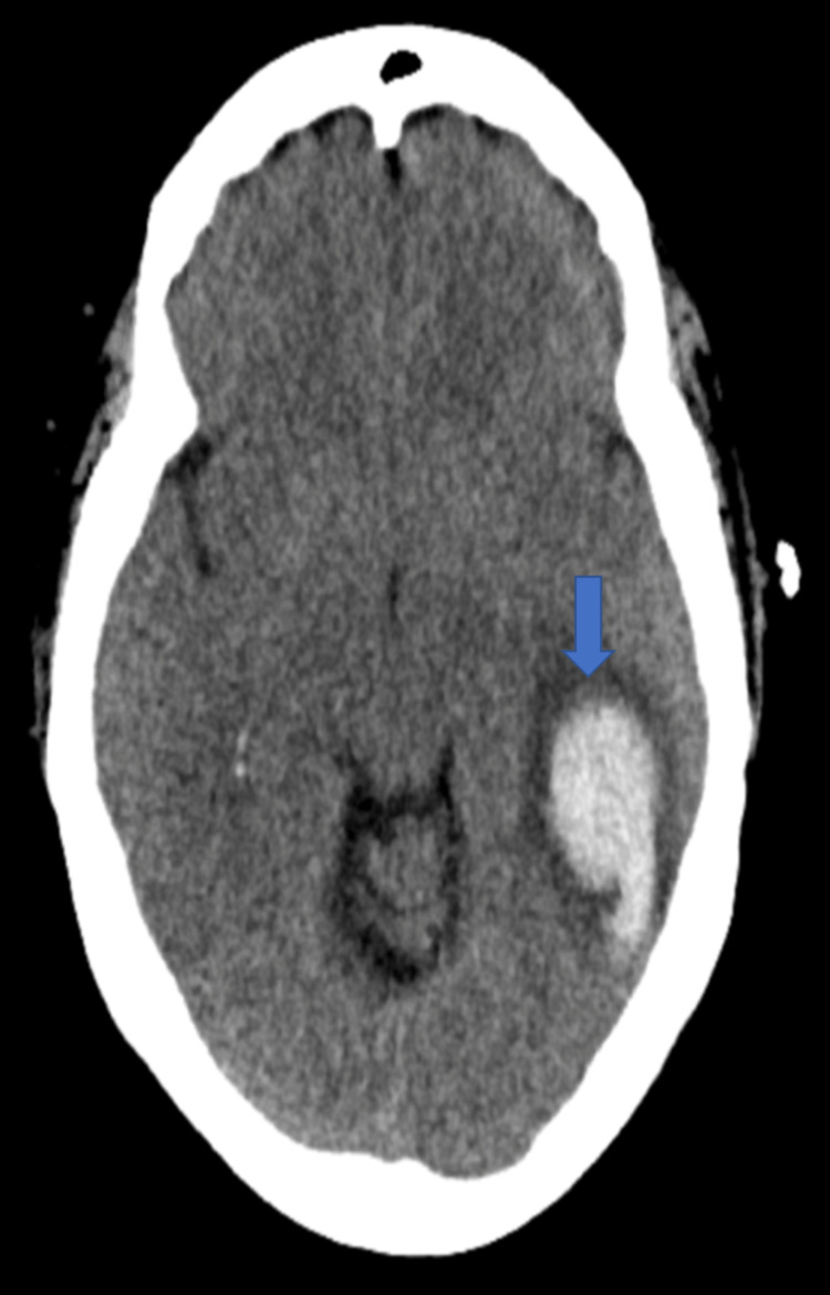 PMC10476695 – FIG6