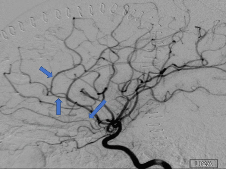 PMC10476695 – FIG7