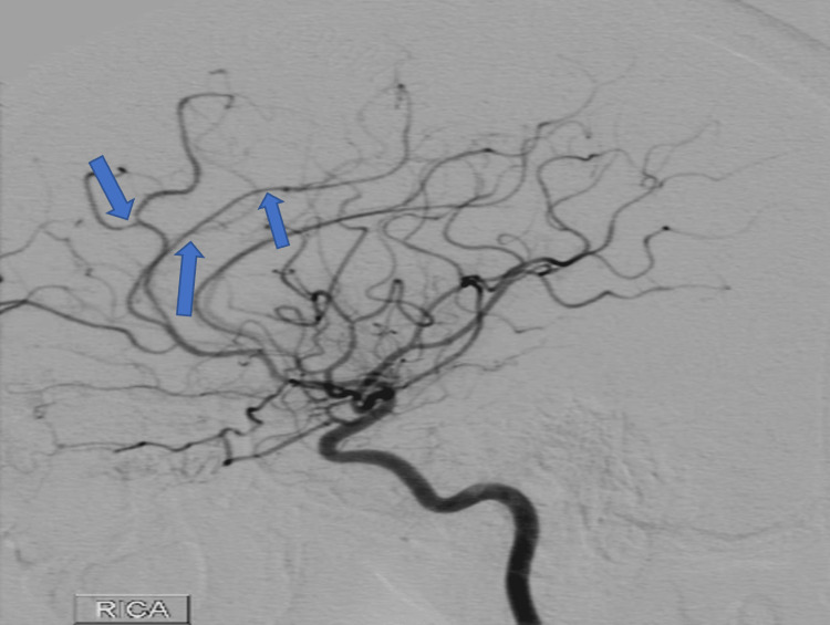 PMC10476695 – FIG8
