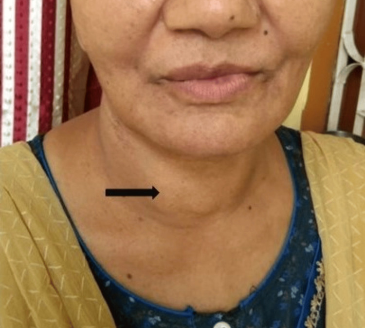 PMC10518057 – FIG1