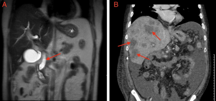 PMC10634612 – FIG1
