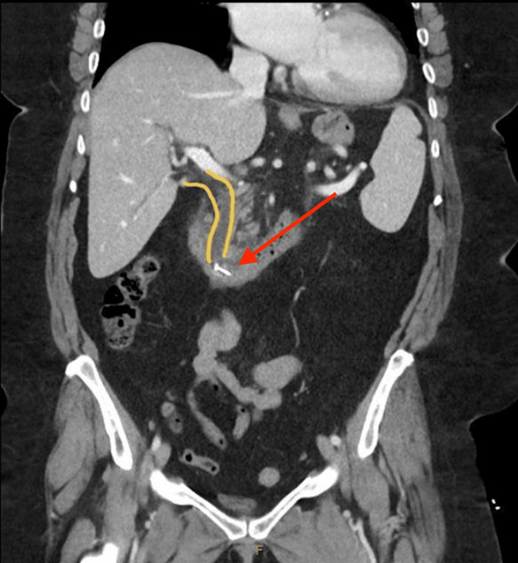 PMC10658215 – FIG2