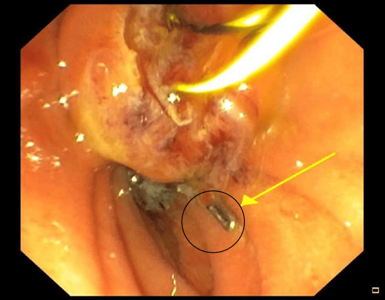 PMC10658215 – FIG3