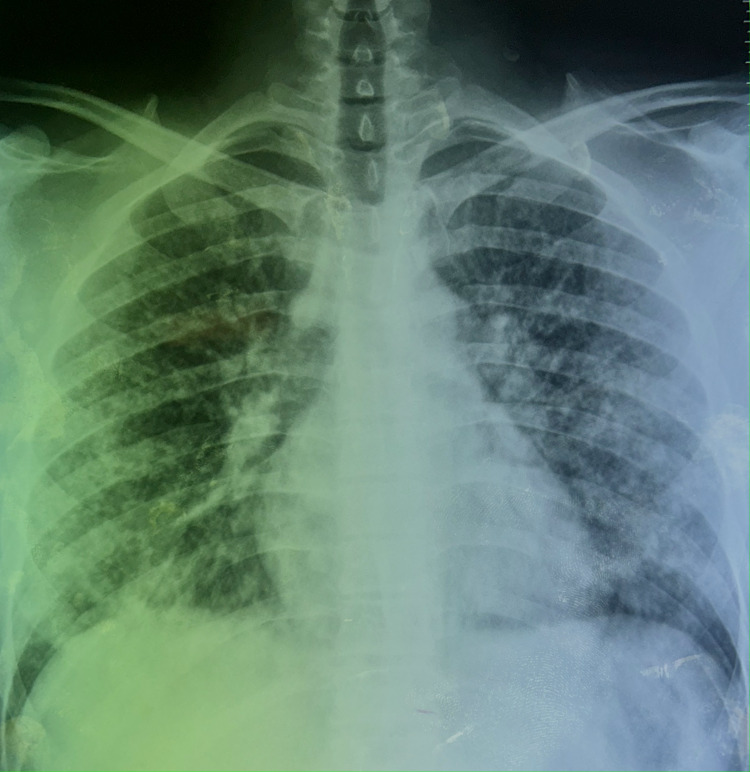 PMC10615356 – FIG1