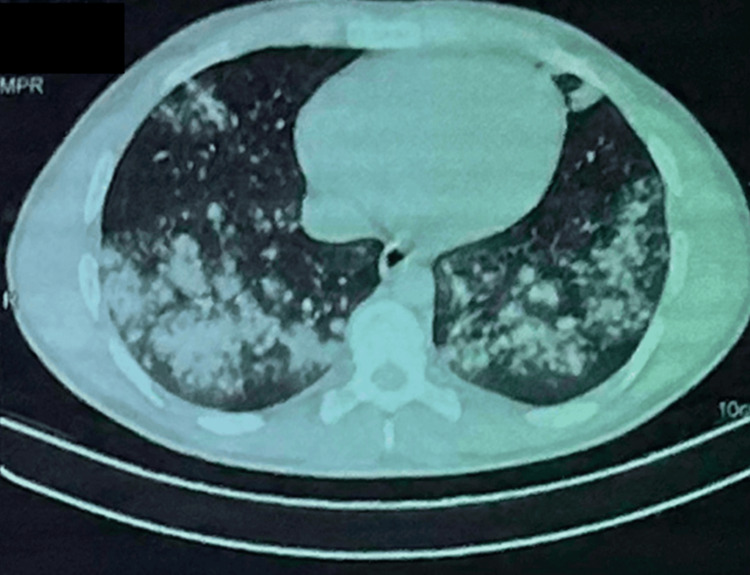 PMC10615356 – FIG2