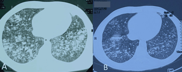 PMC10615356 – FIG3