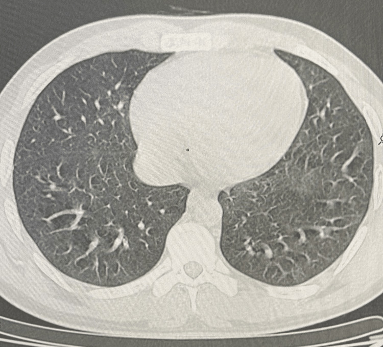 PMC10615356 – FIG4