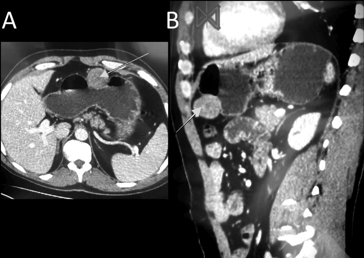 PMC10902725 – FIG1
