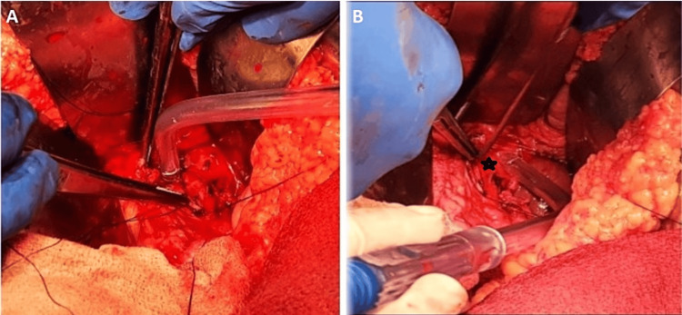 PMC10902725 – FIG2