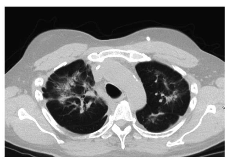 PMC11089483 – FIG1