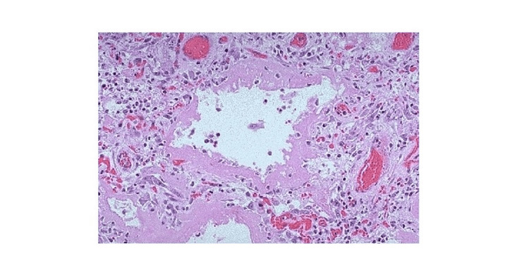 PMC11089483 – FIG2