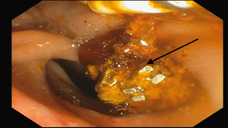 PMC11102600 – FIG1