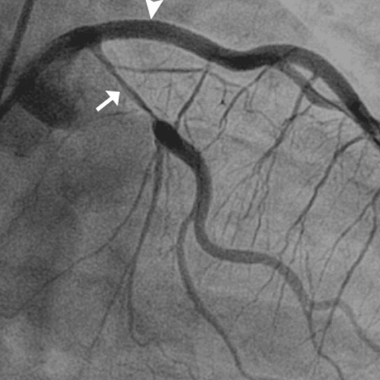 PMC11135382 – FIG1
