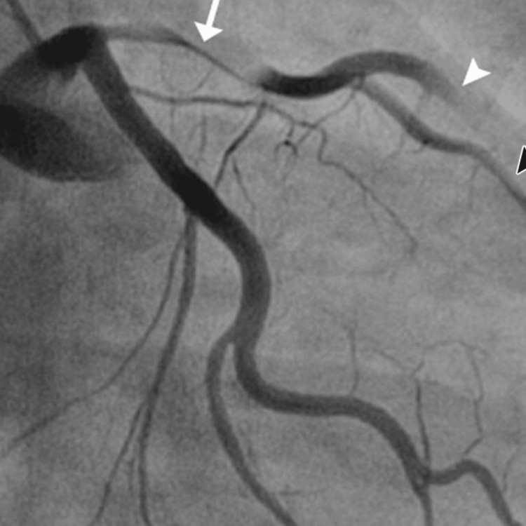 PMC11135382 – FIG2