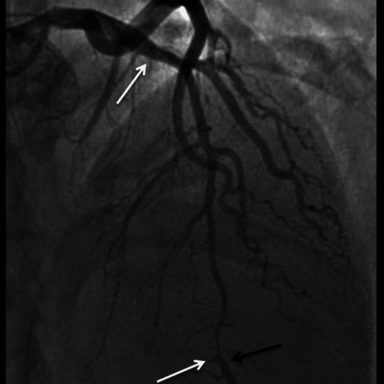 PMC11135382 – FIG3