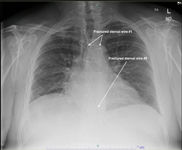 PMC11152356 – FIG1
