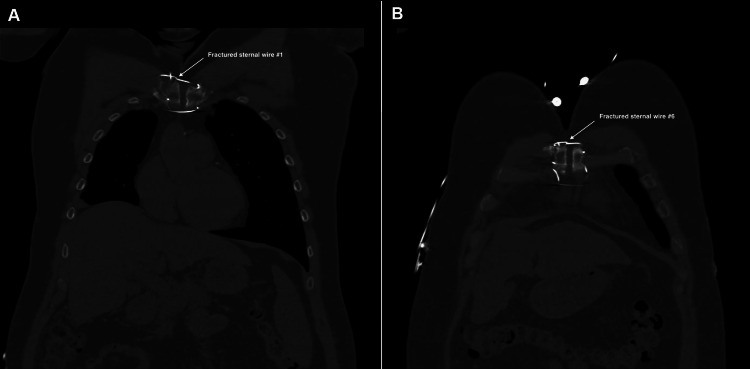 PMC11152356 – FIG2
