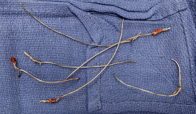 PMC11152356 – FIG3