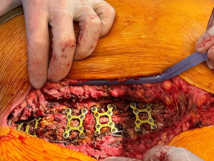 PMC11152356 – FIG4