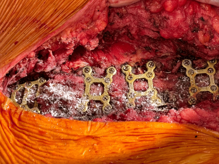 PMC11152356 – FIG5