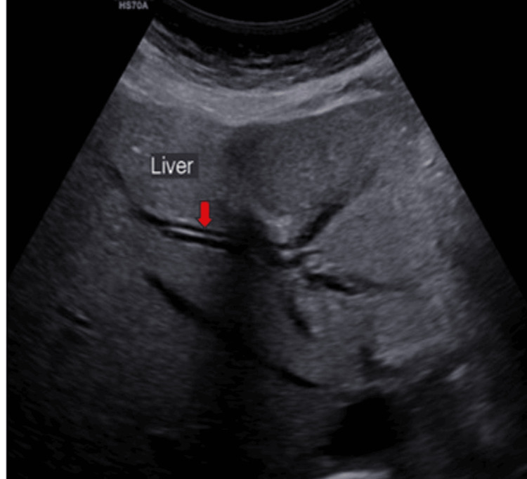 PMC11166205 – FIG1