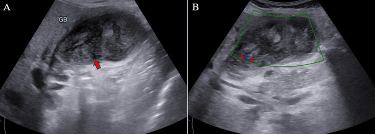 PMC11166205 – FIG2