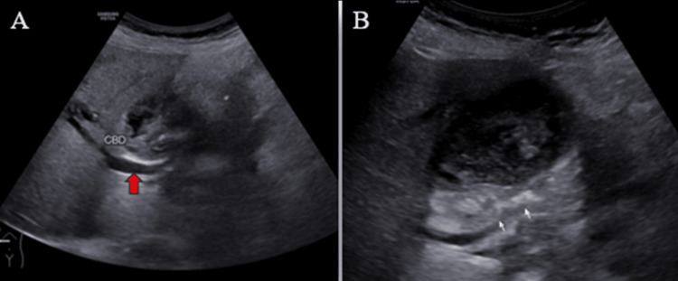 PMC11166205 – FIG3