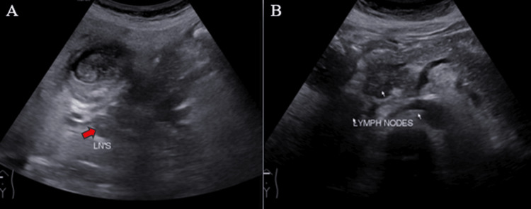 PMC11166205 – FIG4