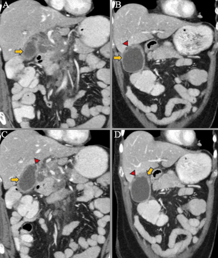 PMC11166205 – FIG5