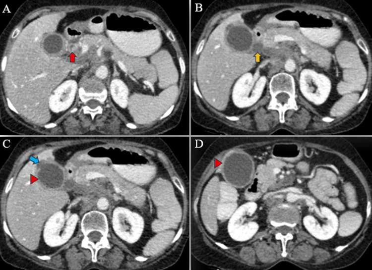 PMC11166205 – FIG6