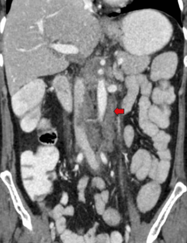 PMC11166205 – FIG7