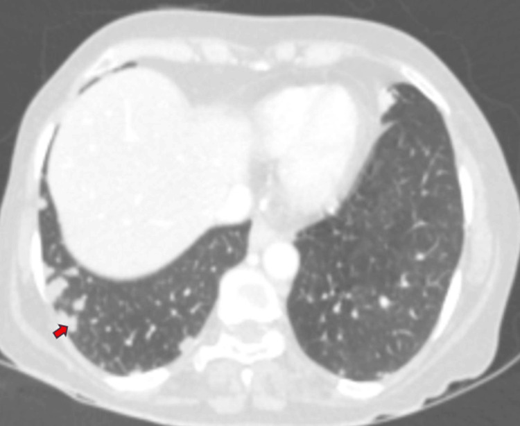 PMC11166205 – FIG8