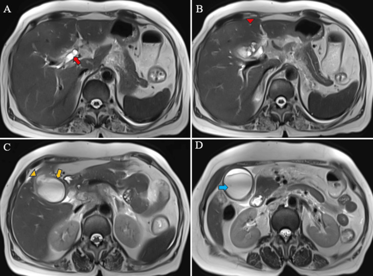 PMC11166205 – FIG9