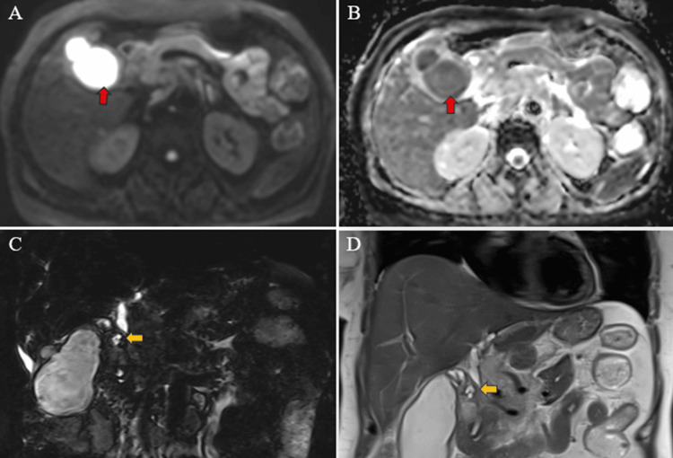 PMC11166205 – FIG10